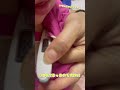 【ダウン症】またもや高熱のこっちゃん #downsyndrome #熱# #ダウン症