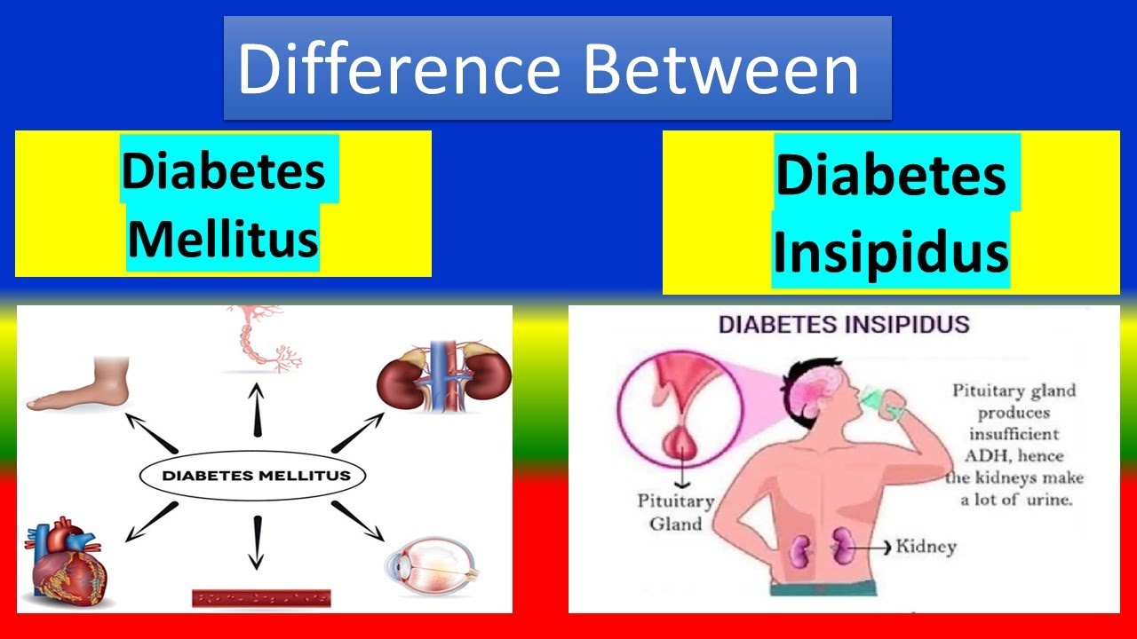 can you have both diabetes mellitus and diabetes insipidus
