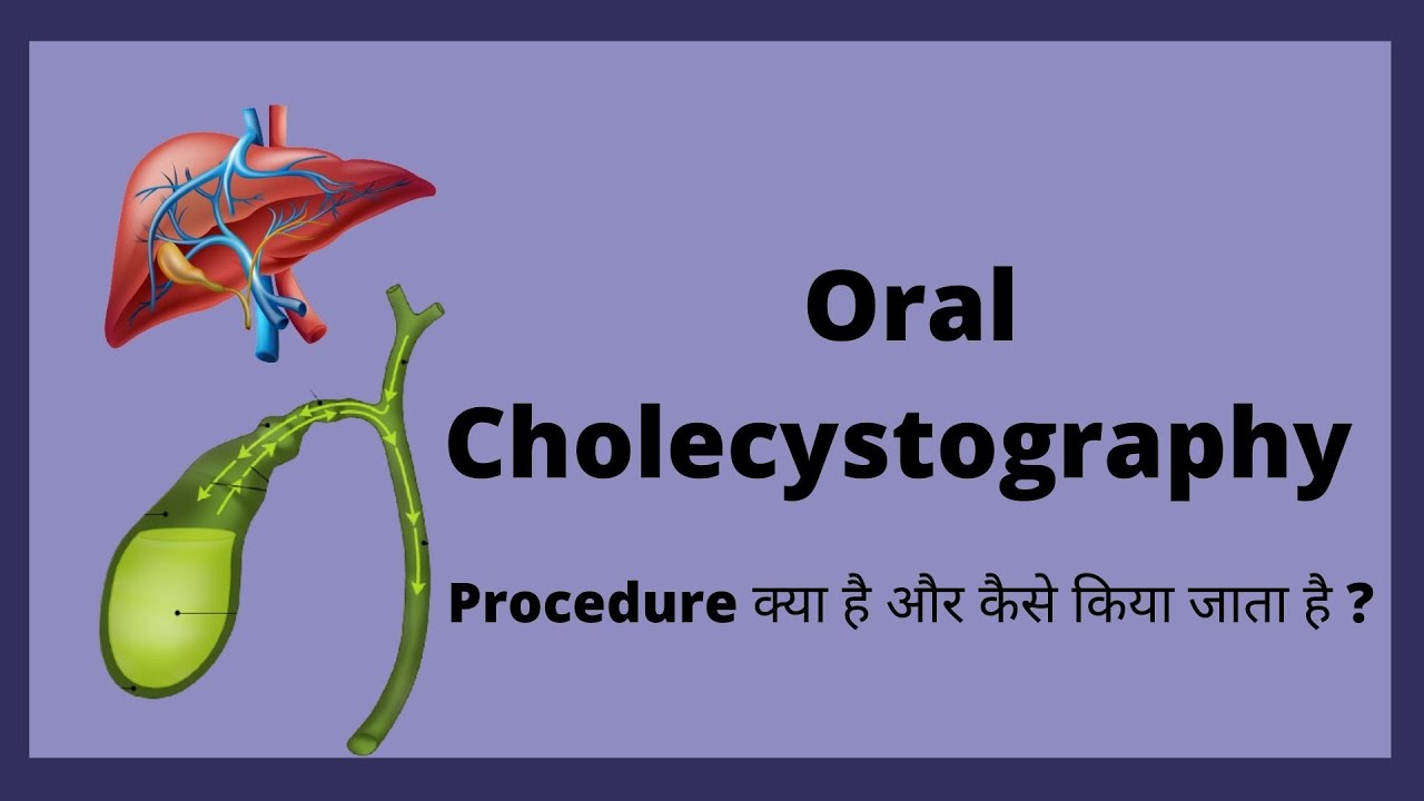 Oral Cholecystography Procedure (OCG) Radiology