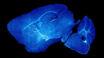 Visualizing Microglia in Whole-Tissue Cleared Mouse Brain