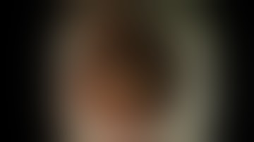 Modified attachment method using an S-O clip for gastric ESD