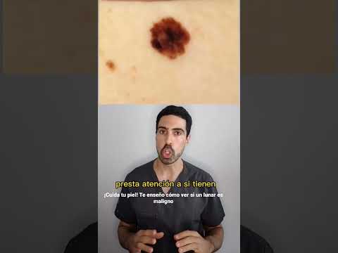 DERMATÓLOGO explica CÓMO