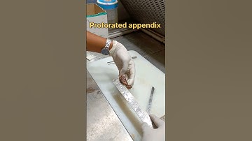 Appendix specimen grossing