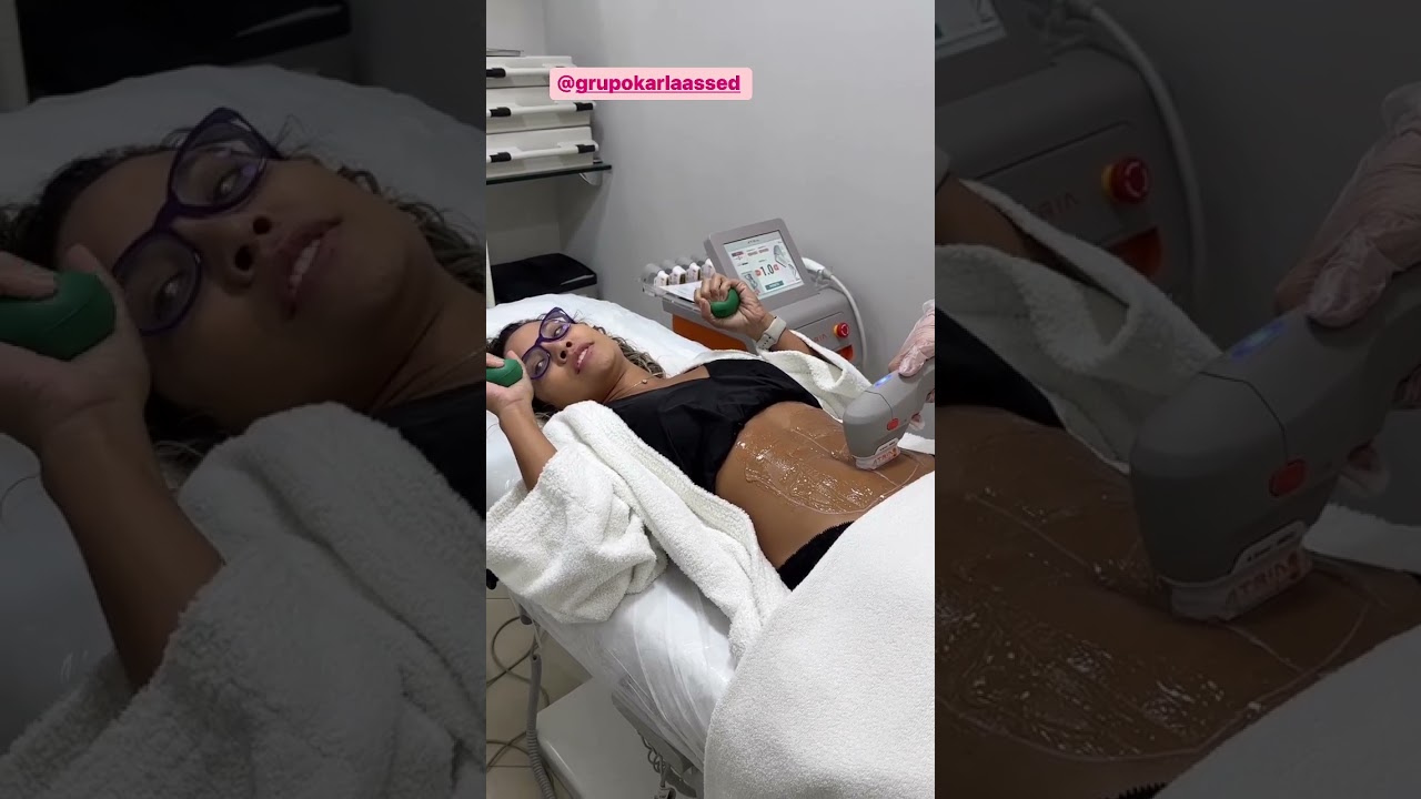 Part3 RAFA NA PARTE FINAL DO TRATAMENTO DA PORCHET !! 