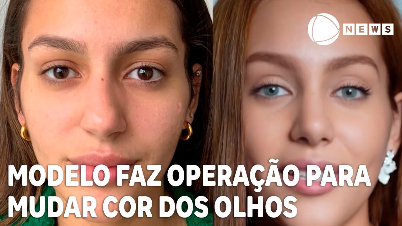 Modelo faz operação para mudar a cor dos olhos