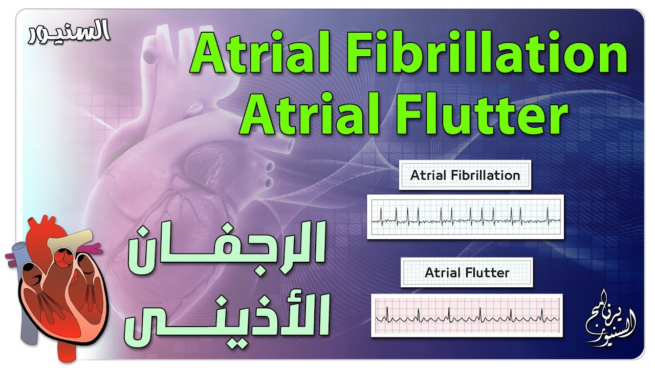 الرجفان الاذينى اعراضة وعلاجة والفرق بين A Fibrillation & A Flutter
