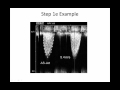 Intro to Aortic Stenosis