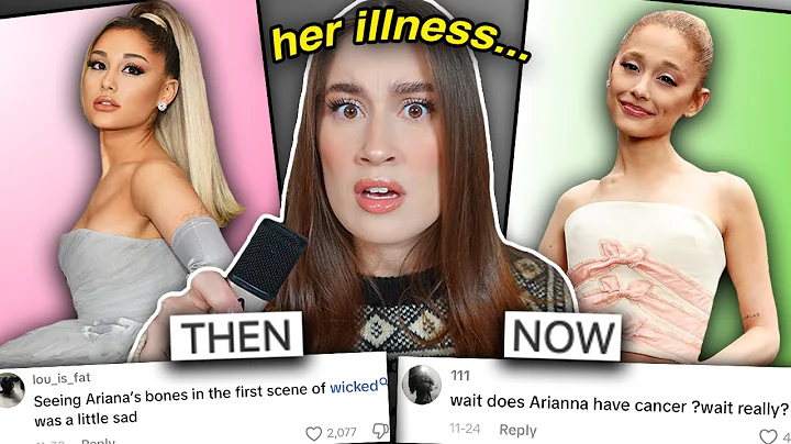 WHAT HAPPENED TO ARIANA GRANDE'S FACE? (irreversible damage)