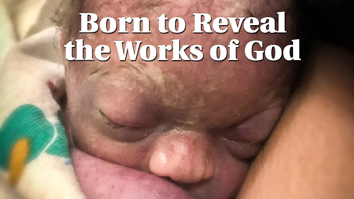Born to Reveal the Works of God | Movie | Stephen ...