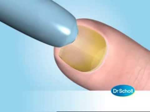 dr scholl hongos uñas precio dr scholl hongos uñas precio