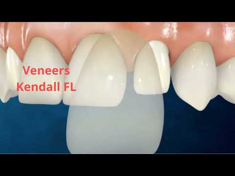 Miami Dental Group - Professional Veneers in Kendall, FL