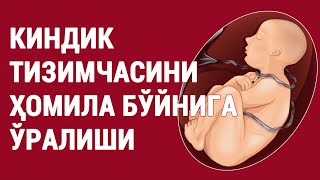 картинка: Киндик тизимчасини ҳомила бўйнига ўралиши