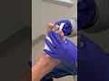 Hammer Toe Pin Removed? Here’s What to Do Next. Part 2