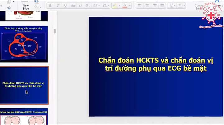 Hội chứng tiền kích thích là gì năm 2024