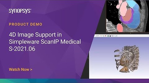4D Image Support in Simpleware ScanIP Medical S-2021.06 | Synopsys