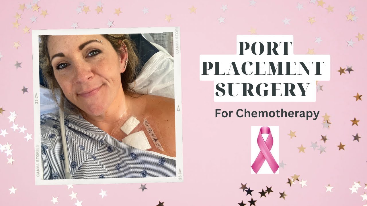 Port Placement Surgery for Chemotherapy Breast Cancer Invasive
