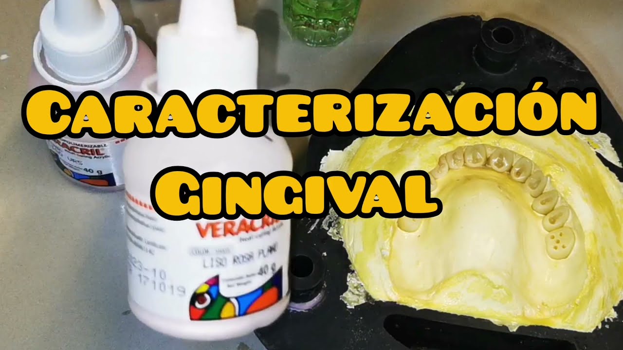 Caracterización gingival con acrílico termopolimerizable