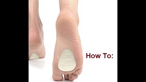 How To: Metatarsal Pads