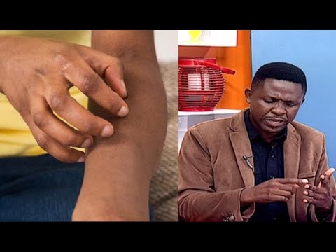 Video: Je, shampoo ipi inafaa zaidi kwa ngozi ya kichwa kuwasha?