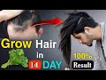 Your hair will grow 7 times faster 🌿Get rid of baldness quickly, A final solution