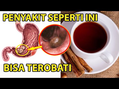 Masya Allah !! Inilah 10 Manfaat Kayu Manis Dan Madu Jika Diminum Setiap Hari