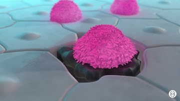 Evaluating Solid Tumor CAR T Efficacy with Organ-on-a-Chip Technology