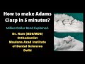 Ideal adams clasp million dollar bend correct undercut to be engaged everything explained dr ram