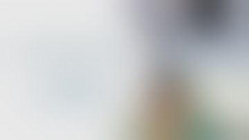 Narrated Robotic Cholecystectomy - da Vinci dV5