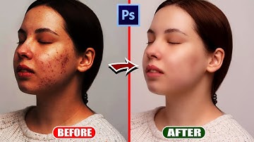 How to make a photo fair in Photoshop | High- End Skin Retouching in Photoshop-फोटो को गोरा कैसे करे