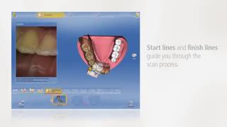 Cerec Omnicam Ortho Scanning