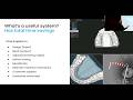 Automation Without Regret: The Key Tradeoffs in Modernizing an Orthodontic Lab