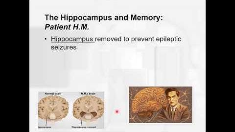 Chapter 12   learning and memory   Using HM to learn about our memory