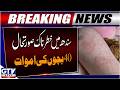 BREAKING: Measles Outbreak | 40 Children Dead | Sindh Health Alert | GTV