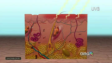 ¿Es bueno el sol para la psoriasis?