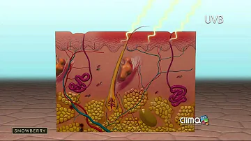 ¿El sol cura la psoriasis?