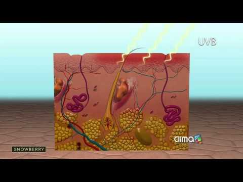 Vídeo: Sol Y Psoriasis: Los Beneficios Y Riesgos