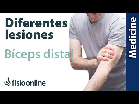 Video: ¿Cuando los bíceps se contraen excéntricamente?