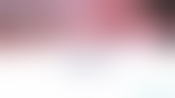 Simultaneous Ridge Augmentation Implant Placement - OSSIX® Plus & bone graft