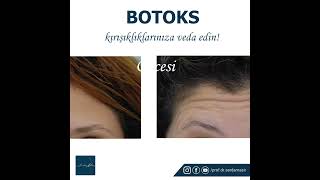 Botoks