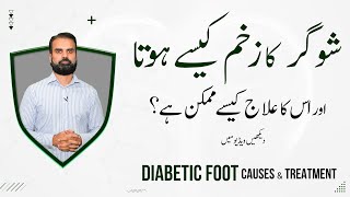 Sugar Ka Zakham Kyn Hota Aur Iska Ilaj | Sugar Diabetic Foot Causes & Treatment in Urdu