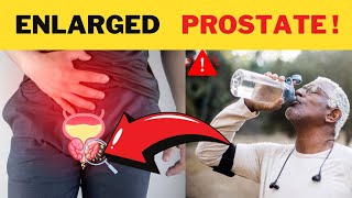 Prostate Pro Tips: 5 Ways to Shrink & Soothe Naturally! #EnlargedProstate #prostatecancer