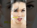 ¿Botox o Relleno? La diferencia que salva tu cara #botoxfacial #rellenosfaciales #rellenodelabios