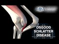 Aoa orthopedic specialists  osgoodschlatter disease