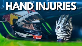 Formula E Hand Injuries :  Why So Often?