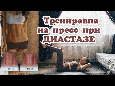 Качаем пресс правильно при диастазе / Плоский животик без вреда для здоровья/Тренировка для новичков