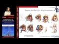 Management of venous tos tam huynh md