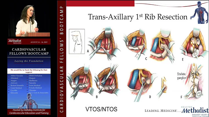 Management of Venous TOS (Tam Huynh, MD)