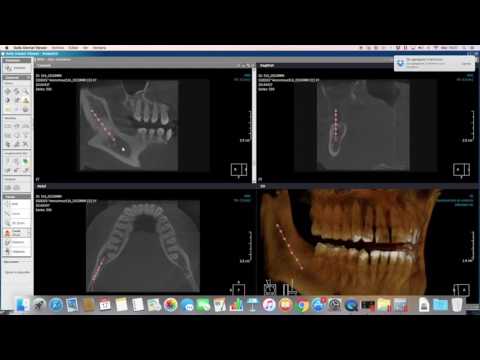 xelis dental cd viewer