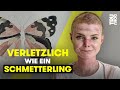 “Ich bin mehr als meine Krankheit!” - Julia (24) kämpft für ihre Träume | TRU DOKU