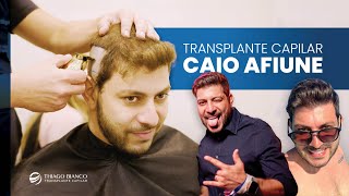 Transplante capilar com Caio Afiune